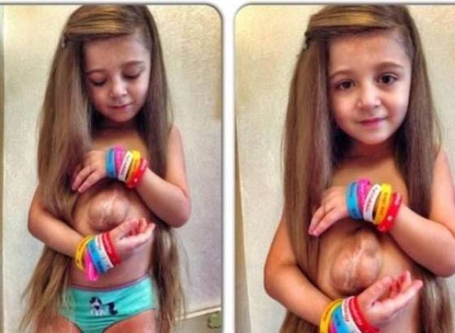 This Little Girl Proves That Life Is What You Make of It