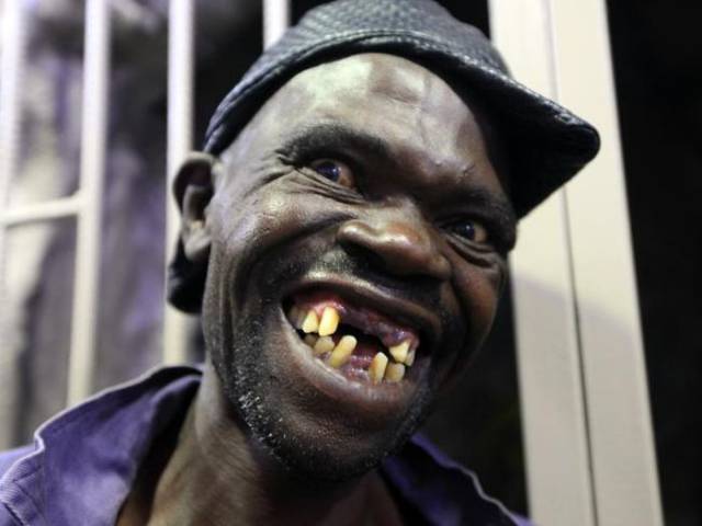 The World’s Ugliest Man of 2015 (8 pics) - Izismile.com