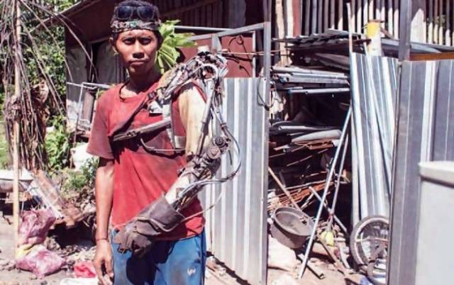 This Indonesian Guy Is a Real Life Bionic Man
