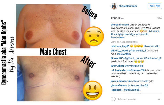 Dr. Miami Shares His Plastic Surgery Success Stories on Instagram Dr. Miami Shares His Plastic Surgery Success Stories on Instagram