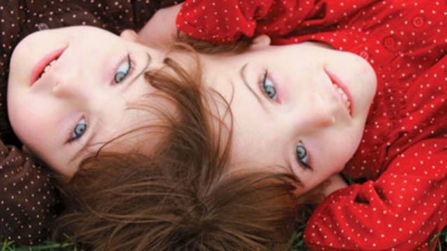 Fascinating Facts About Twins That Will Make Your Jaw Drop