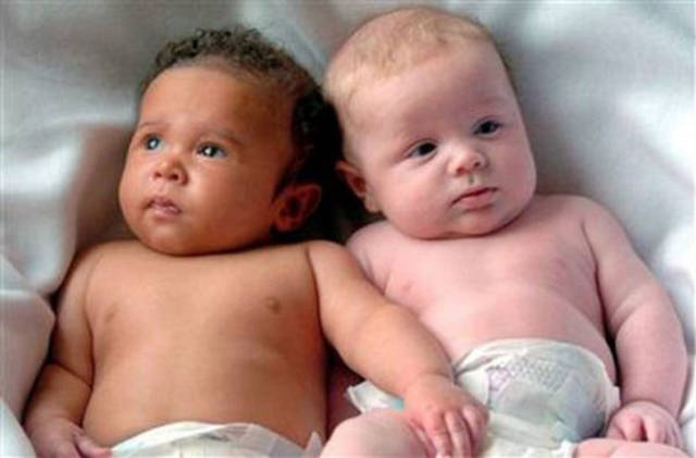 Fascinating Facts About Twins That Will Make Your Jaw Drop