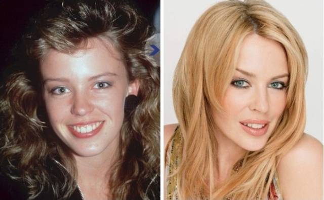 Priceless Photos Showing How Celebs Looked Back In The Day