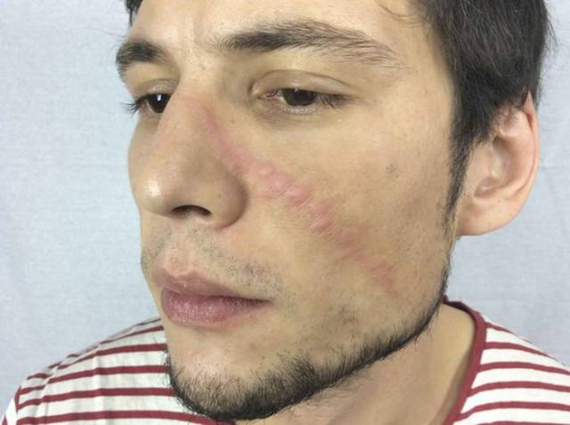 How To Create Realistic Cuts And Scars How To Create Realistic Cuts And Scars