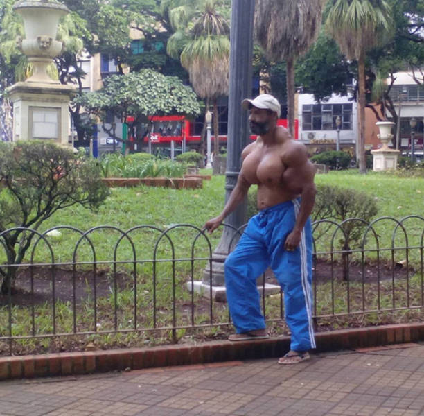 Another Synthol Freak Who Will Make You Cringe