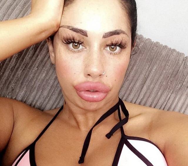 This Mum Has Already Huge Lips But She Wants Them Even Bigger