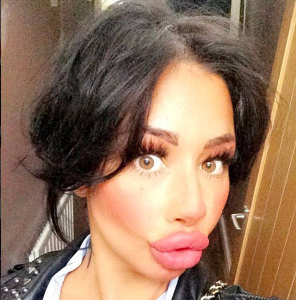 This Mum Has Already Huge Lips But She Wants Them Even Bigger