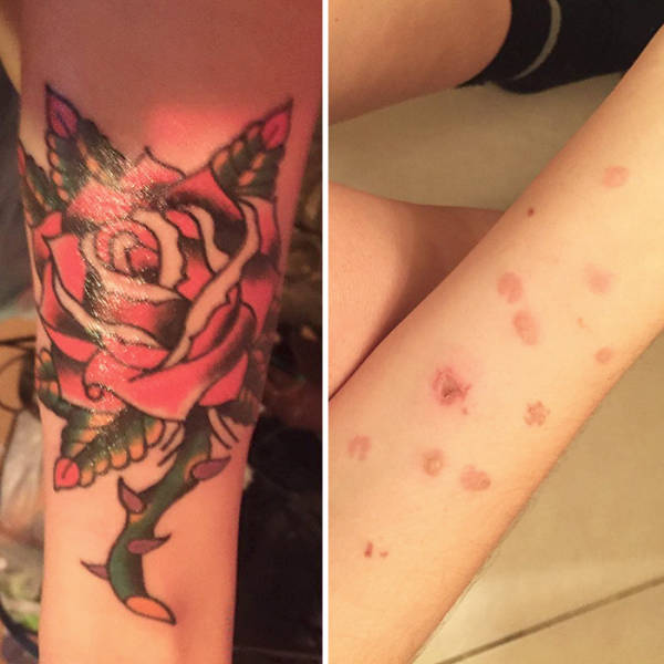 Interesting Stories Behind Scars And The Amazing Tattoos That Cover Them Up