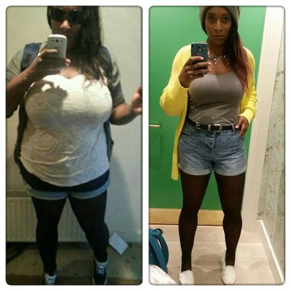 Before And After Weight Loss Photos