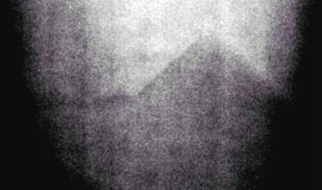 Scary Mysterious Photos And The History Behind Them