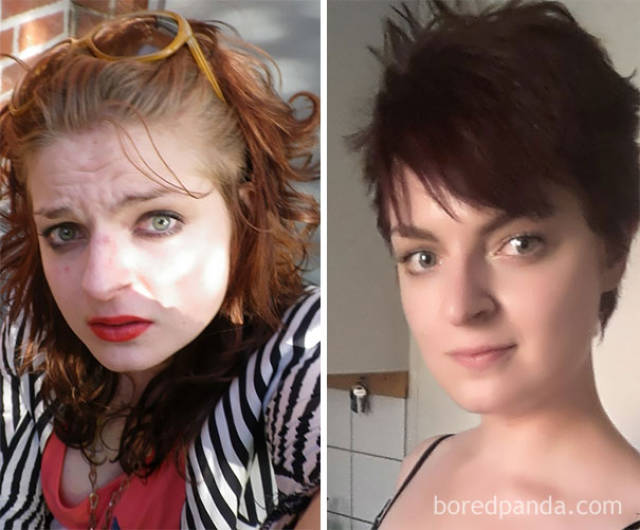Staggering Physical Transformations Of Heavy Drinkers After They Gave Up Alcohol