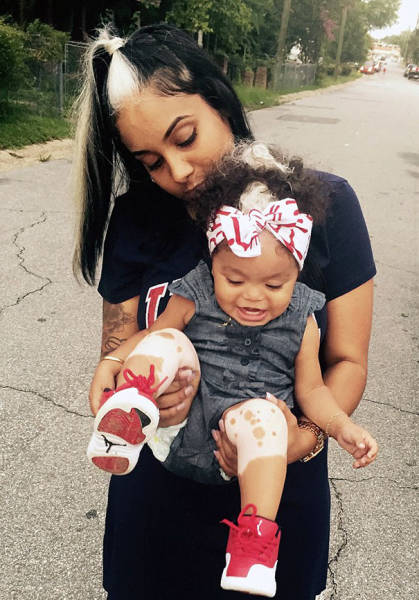 You’ve Never Seen A Newborn With Such Hair Before