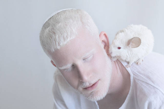 These Beautiful Albino People Are Simply Breathtaking