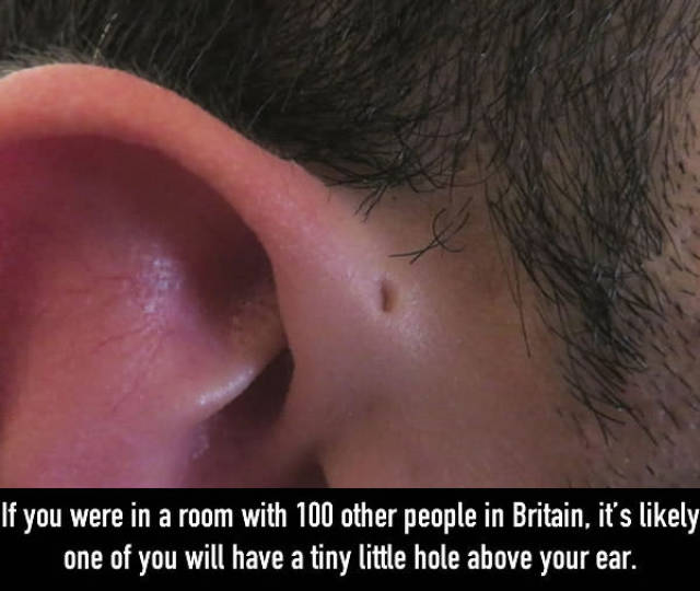 Have You Ever Wondered Why Some People Have These Little Holes Above Their Ears?