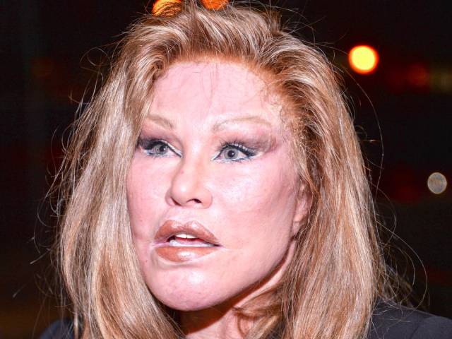 You Couldn’t Even Imagine All Of That Is Life Of One Person - Jocelyn Wildenstein The Catwoman